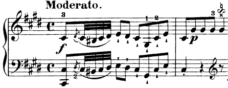 Haydn - misunderstood detached notes.PNG